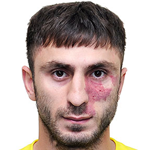 Karlen  Mkrtchyan